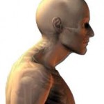 Forward-head-posture-condition