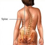 Spine showing scoliosis