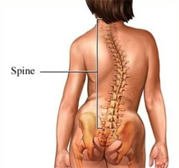 Spine showing scoliosis