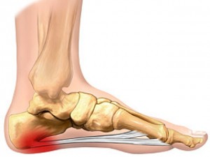 plantar-fascia_13